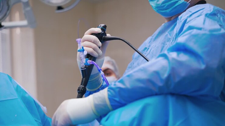 Laparoscopy